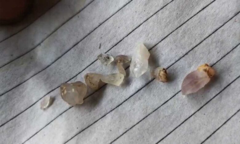 छतरपुर-के-मजदूर-की-किस्मत-पलटी,-एक-साथ-मिले-8-हीरे,-बना-लखपति