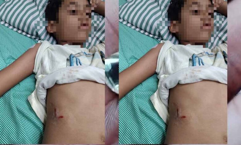 पेबल-बे-फेस-1,-बागमुगलिया-कटारा-हिल्स-में-आवारा-कुत्ते-ने-बच्चे-को-काटा