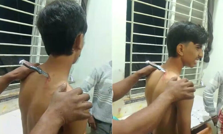 महिदपुर-में-मामूली-विवाद-के-दौरान-नाबालिग-पर-हमला,-घायल-46-किमी-दूर-अस्पताल-पहुंचा