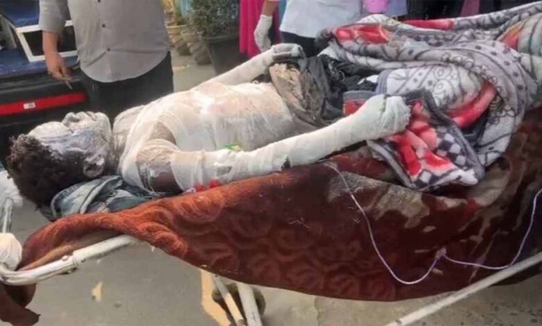 मंगल-कार्बन-प्लांट-में-भीषण-ब्लास्ट:-9-माह-के-मासूम-सहित-8-मजदूर-झुलसे,-हालत-नाजुक