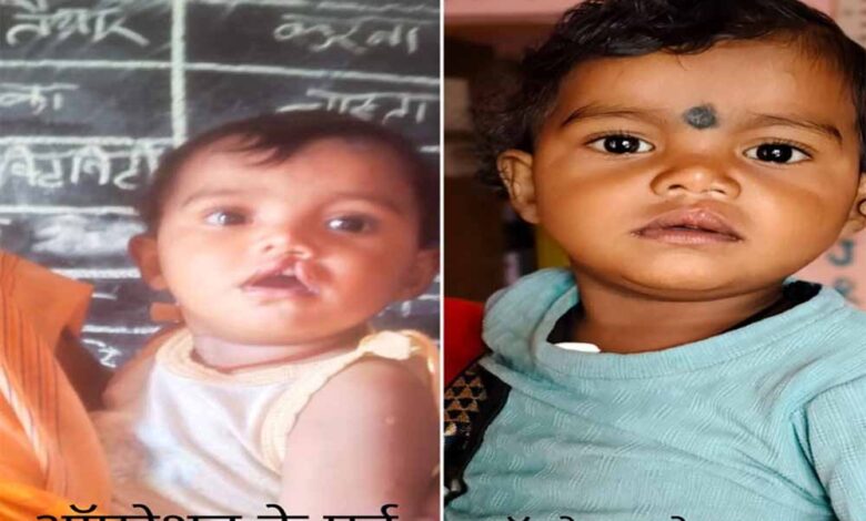 शासन-की-योजना-से-दूर-हुई-बेटी-के-भविष्य-की-चिंता,-चिरायु-दल-ने-लौटाई-मासूम-रंजना-की-मुस्कान