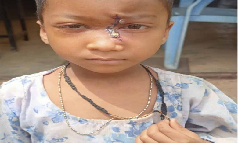 पिता-के-साये-और-आर्थिक-तंगी-के-बीच-चिरायु-योजना-बनी-सहारा,अंजलि-को-मिला-नया-जीवन