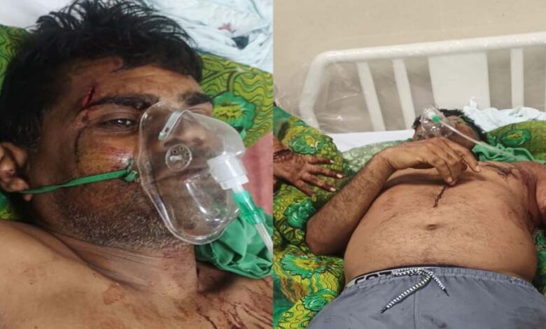 कुल्हाड़ी-से-हमला:-गाली-गलौज-का-विरोध-करने-पर-पूर्व-जनपद-सदस्य-प्रतिनिधि-पर-जानलेवा-वार