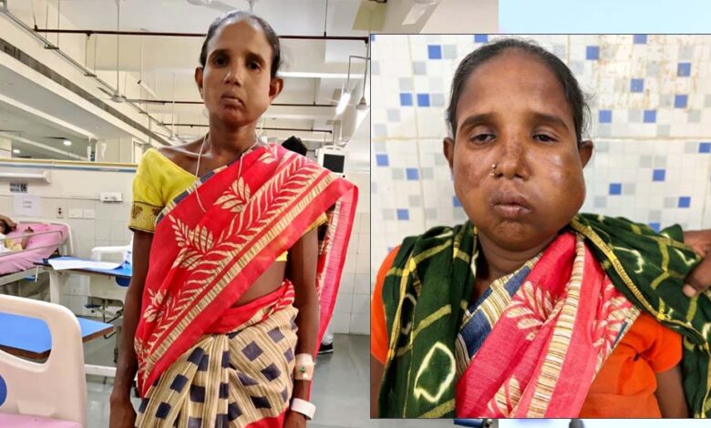 रायपुर:-संजीवनी-बना-मेगा-सुपर-स्पेशलिटी-हेल्थ-कैंप,-बुधरी-मड़कम-को-मिला-नया-जीवन