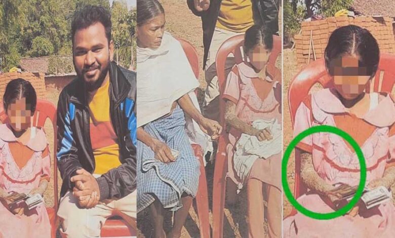 पत्थर-शरीर-वाली-बच्ची-के-उपचार-को-लेकर-बाल-आयोग-सक्रिय